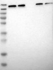 NBP1-81651 - UGCGL1 / RUGT