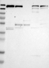 NBP1-81652 - UGCGL1 / RUGT