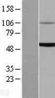 NBL1-17598 - UGT1A6 Lysate