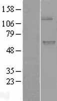 NBL1-17600 - UGT1A9 Lysate
