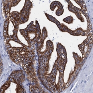 NBP1-81486 - UHRF1BP1L