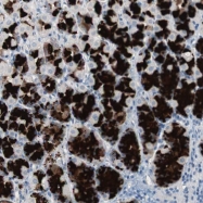 NBP1-80856 - ULBP1 / NKG2D ligand 1