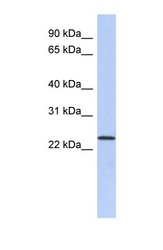 NBP1-59052 - ULBP1 / NKG2D ligand 1