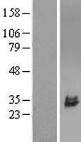 NBL1-17606 - ULBP2 Lysate