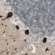 NBP1-88881 - Unc-51-like kinase 2 (ULK2)