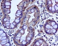 NBP1-96042 - Unc-51-like kinase 3 (ULK3)