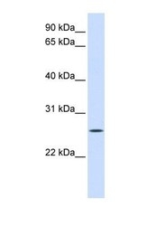 NBP1-59665 - UNC50
