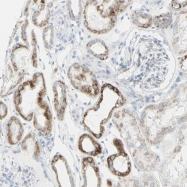 NBP1-87367 - UNC5B