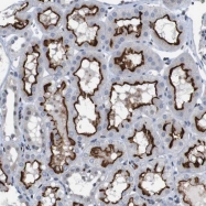 NBP1-86476 - UNC5C