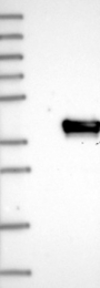 NBP1-80646 - Uridine phosphorylase 2 (UPP2)