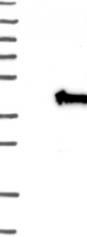 NBP1-80647 - Uridine phosphorylase 2 (UPP2)
