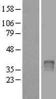 NBL1-17626 - UPP2 Lysate