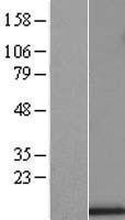 NBL1-17628 - UQCRB Lysate