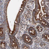 NBP1-85328 - UQCRC1 (Complex III subunit core 1)