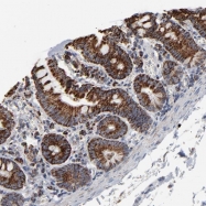 NBP1-85329 - UQCRC1 (Complex III subunit core 1)
