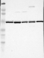 NBP1-85328 - UQCRC1 (Complex III subunit core 1)