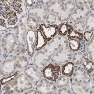 NBP1-80861 - UQCRC2 (Complex III subunit Core 2)