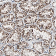 NBP1-80862 - UQCRC2 (Complex III subunit Core 2)