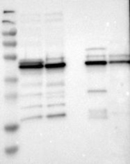 NBP1-80861 - UQCRC2 (Complex III subunit Core 2)