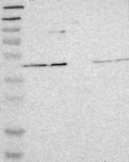 NBP1-80862 - UQCRC2 (Complex III subunit Core 2)