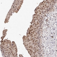 NBP1-87983 - URG4