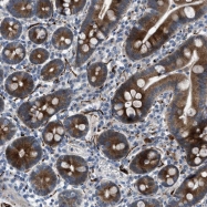 NBP1-87985 - URG4
