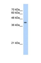 NBP1-56662 - UROD