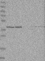 NBP1-89513 - UROD