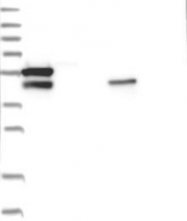 NBP1-89189 - USH1C / Harmonin