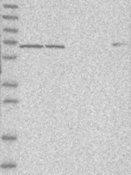NBP1-89190 - USH1C / Harmonin
