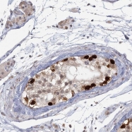 NBP1-80639 - USP11