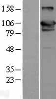 NBL1-17651 - USP20 Lysate