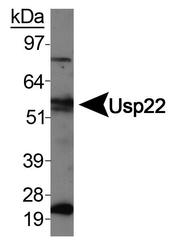 NBP1-49644 - USP22