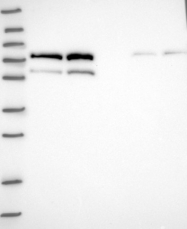 NBP1-82941 - USP22