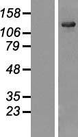 NBL1-17654 - USP25 Lysate