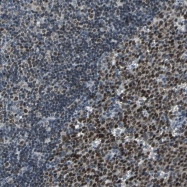 NBP1-82905 - USP28