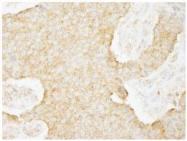 NB100-77284 - USP3