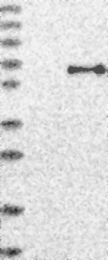 NBP1-81914 - USP30