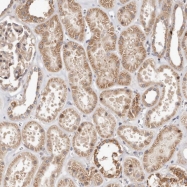NBP1-82931 - USP33 / VDU1
