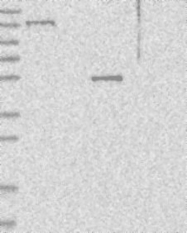 NBP1-82039 - USP43