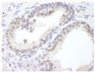 NB100-57487 - USP47