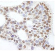 NB100-57487 - USP47