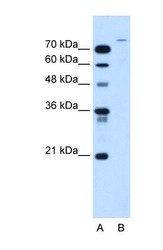 NBP1-59752 - USP48