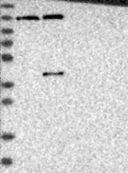 NBP1-83751 - USP48