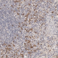 NBP1-81174 - USP49