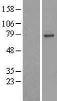 NBL1-17668 - USP49 Lysate