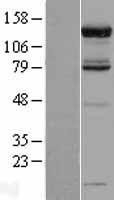 NBL1-14090 - USP52 Lysate