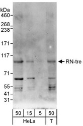 NBP1-47264 - USP6NL