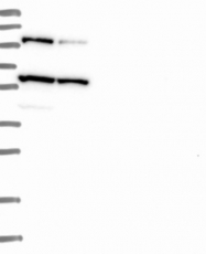 NBP1-83061 - USP6NL