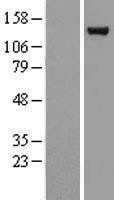 NBL1-17671 - USP7 Lysate